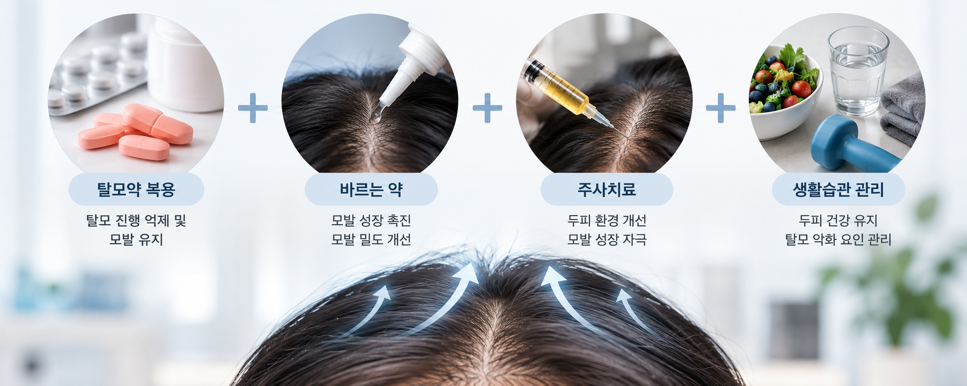 탈모 치료와 관리 인포그래픽.png